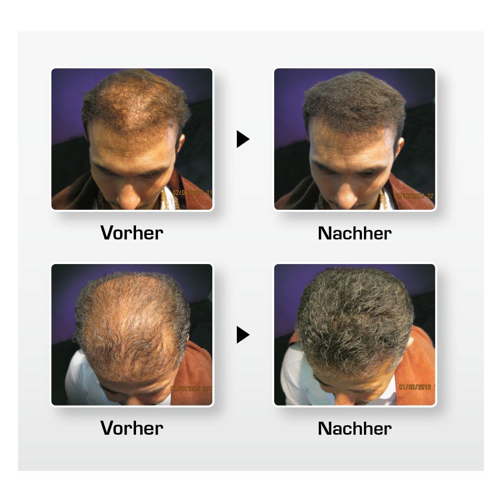 BioThik Haaraufbau-Faser S5 dunkelblond 25 g