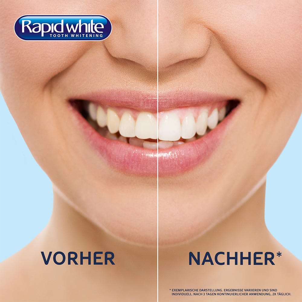 Rapid White Bleaching Strips