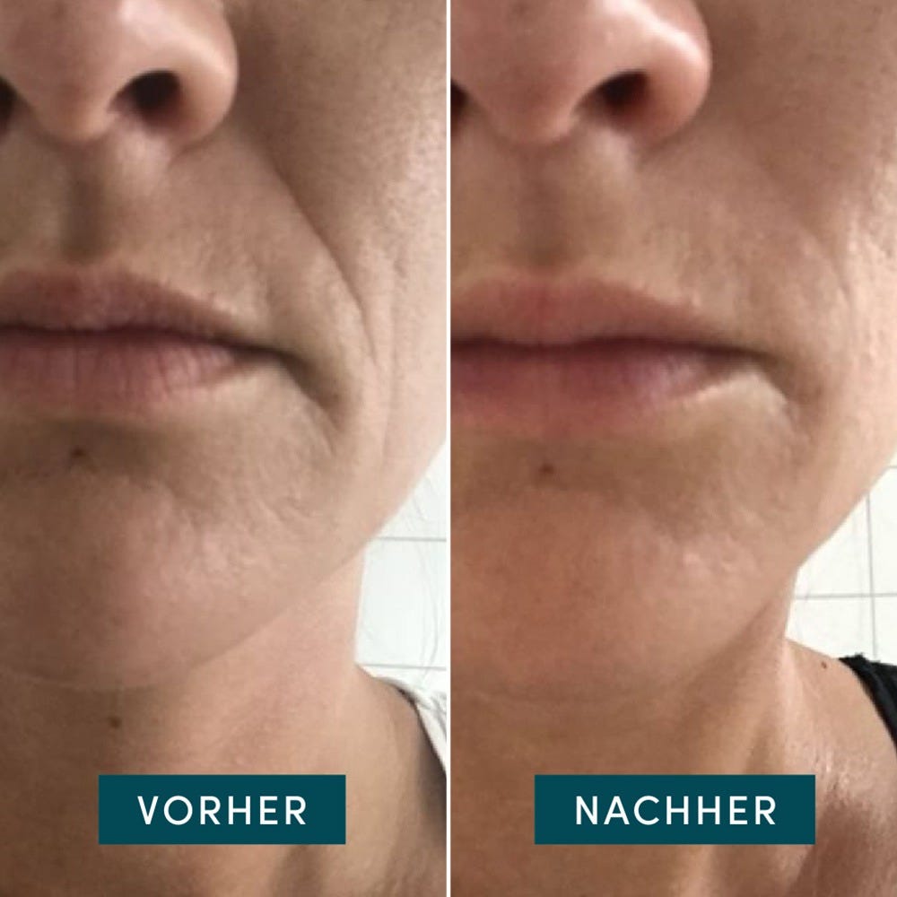 APRICOT Wiederverwendbare Mund Pads mit Hyaluron