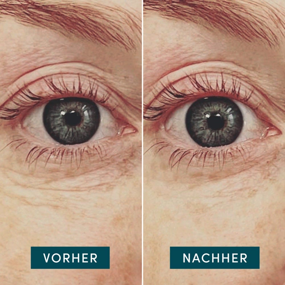 Apricot Wiederverwendbare Augen Pads mit Hyaluron