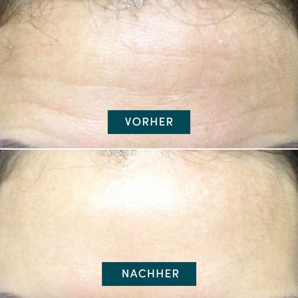 Apricot Wiederverwendbares Stirn Pad mit Aloe Vera