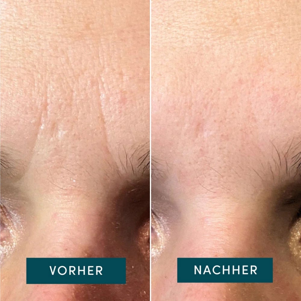 APRICOT Gesicht Patches mit Panthenol 100 Stück