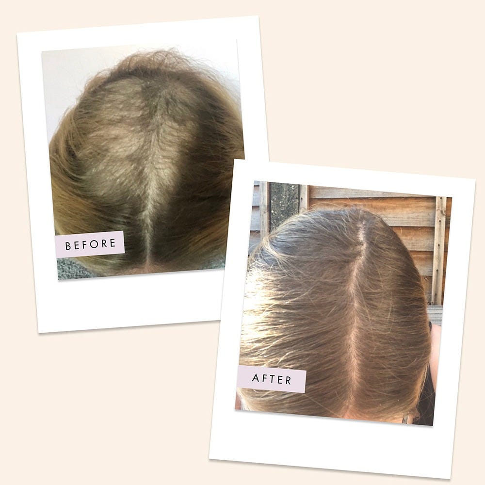 HAIR GAIN Hair Capsules 1 Month Supply  60 Stück 