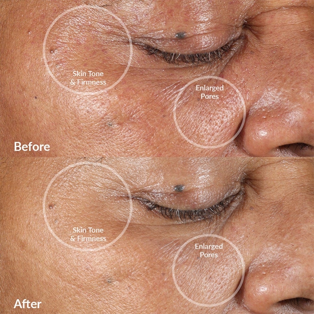 PMD Beauty Clean Pro RQ Rose