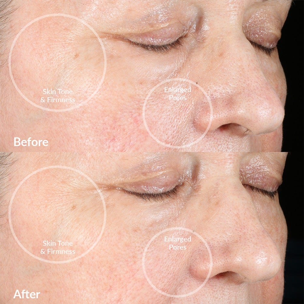 PMD Beauty Clean Pro RQ Rose
