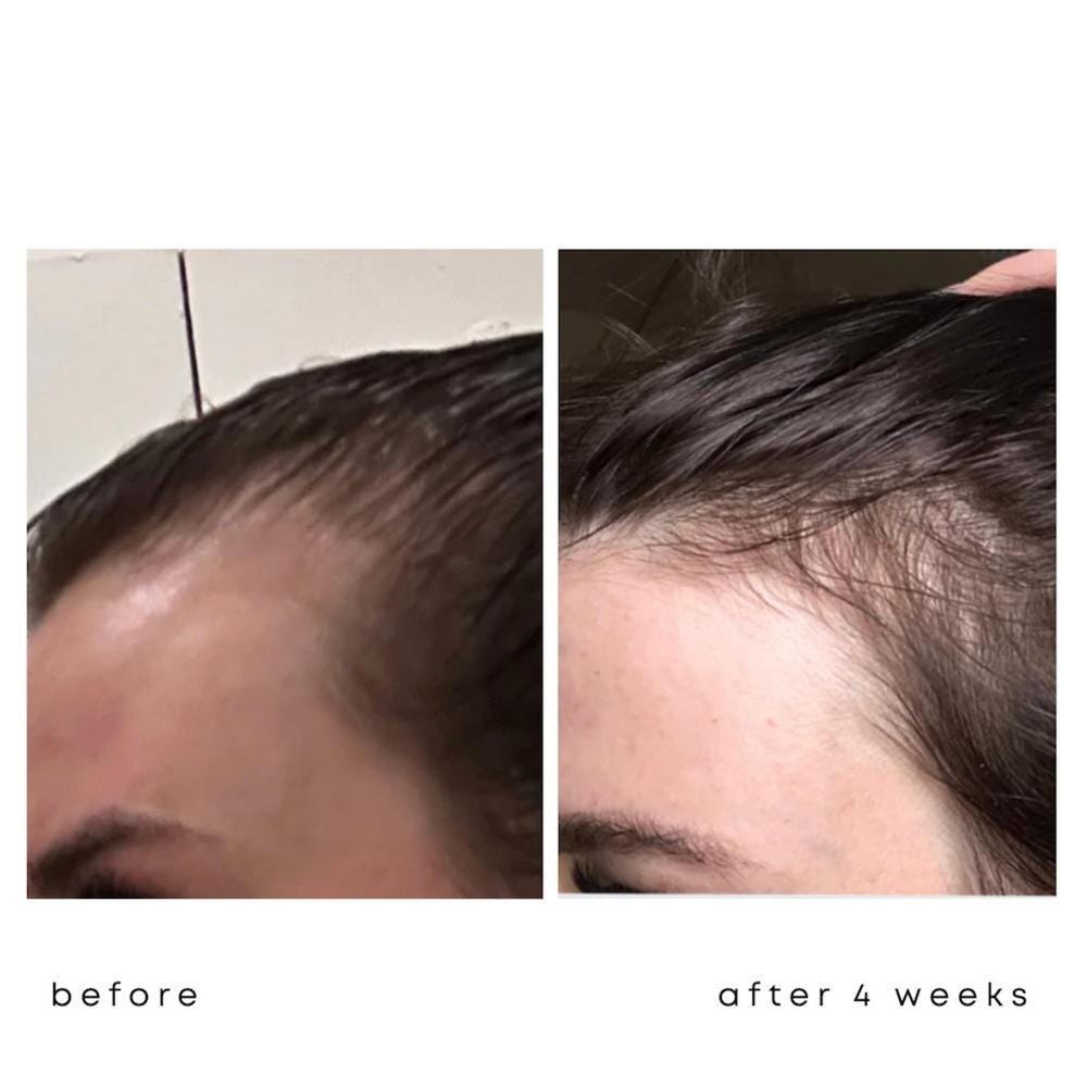 trucosmetics Hair Growth Serum 50 ml